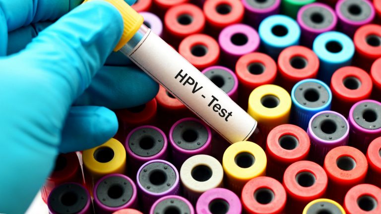 Test HPV