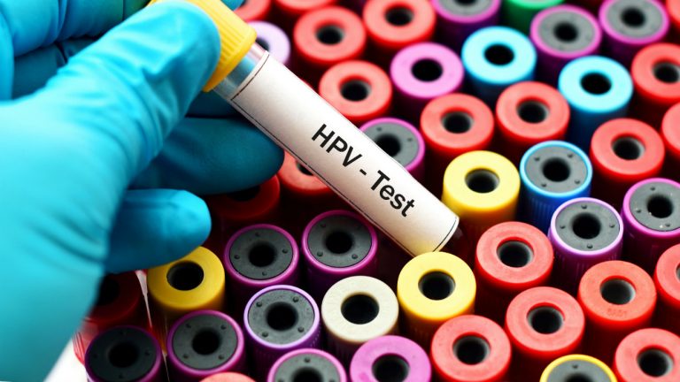 Test HPV